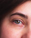 The Complete Guide to Wrinkle Treatment: Prevention, Solutions, and Management
